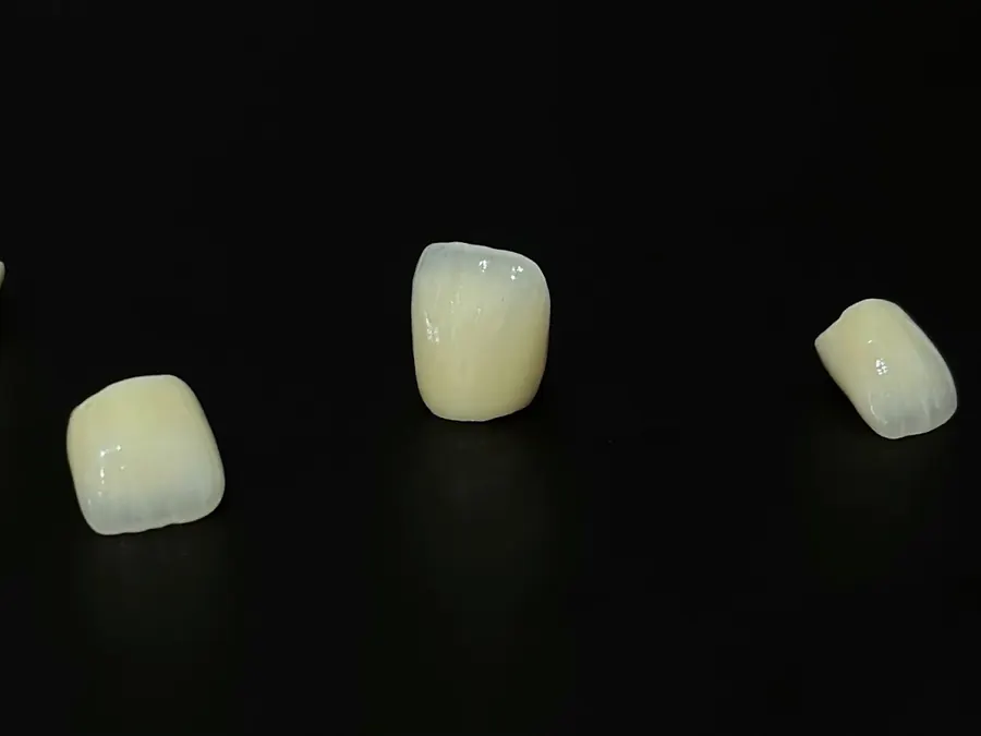 Patru lucrări ceramice unitare pe fundal negru